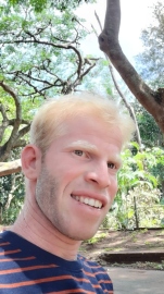 Faced with albinism, visual impairment at birth, twin brothers hail NAB for giving them a shot at life