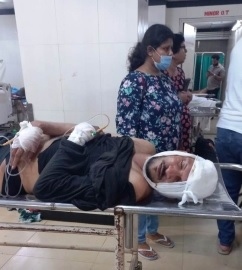 Amid custodial assault allegation, police cite Edberg Pereira's accidental fall at PS