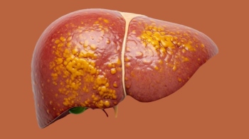 THE HEALTHY GOANUnderstanding fatty liver disease: A modern epidemic