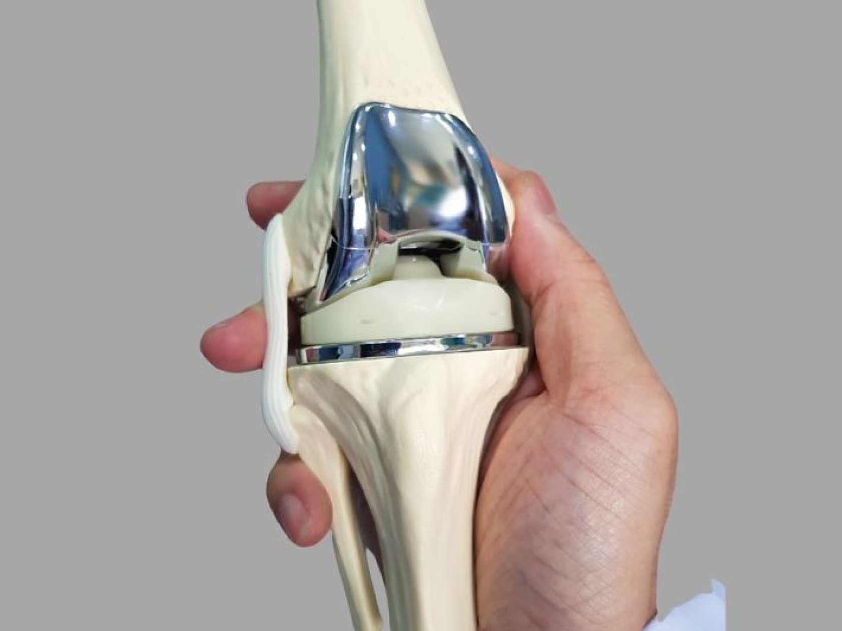 AI-aided knee replacement performed at Asilo