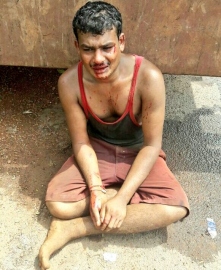 Labourer severely beaten by truck-driver at Karaswada
