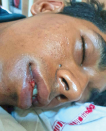 Investigation in Fatorda assault complete, all eyes now on DGP