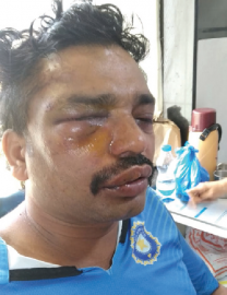 Yellow-black taxi driver assaulted by fellow driver at Vasco