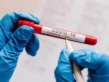 Frequent, rapid testing can wipe out Covid in weeks: Study
