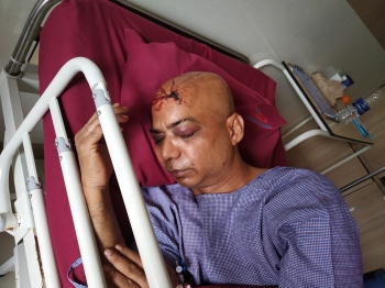 Armed men attack Verla businessman