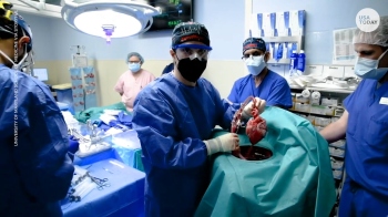 Pig heart for human being raises ethical questions