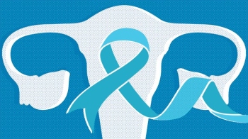 Ovarian cancer: Common myths debunked