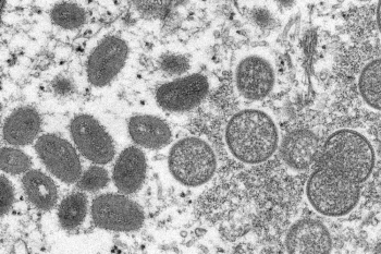 What is monkeypox and where is it spreading?