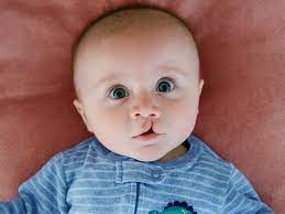 Is cleft lip, palate still a social stigma?